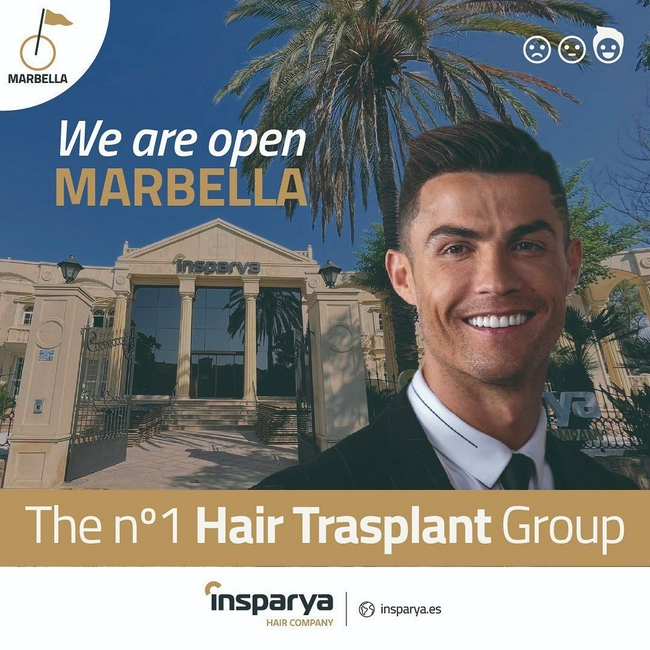 Ronaldo promueve su propia empresa de trasplantes de cabello: ha cambiado la vida de 40.000 personas